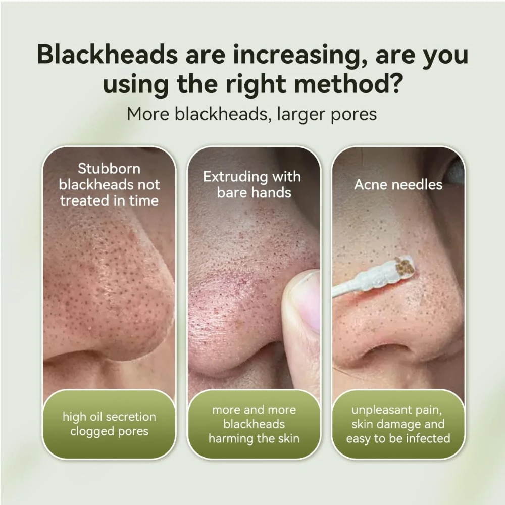 LANBENA 2.0 Nose Pore Strips, Blackhead Remover Mask with Salicylic Acid